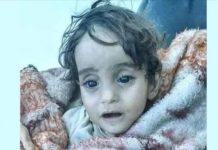Devojčica Iman preminula od hladnoće jer je Assadov režim ostavio bez doma