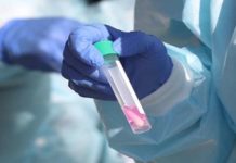 10 miliona obolelih, pola miliona umrlih u svetu 10-miliona-obolelih,-pola-miliona-umrlih-u-svetu