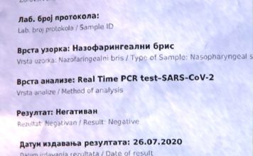 Negativan poslednji test dr Avdulja Škrijelja negativan-poslednji-test-dr-avdulja-skrijelja