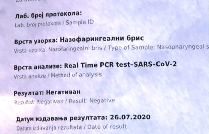 negativan-poslednji-test-dr-avdulja-skrijelja negativan-poslednji-test-dr-avdulja-skrijelja