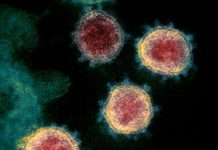 Bez preminulih, 22 pacijenta na bolničkom lečenju bez-preminulih,-22-pacijenta-na-bolnickom-lecenju