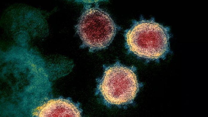 bez-preminulih,-22-pacijenta-na-bolnickom-lecenju