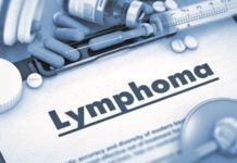 LIMFOM: Rano otkriven uspešno se leči limfom:-rano-otkriven-uspesno-se-leci