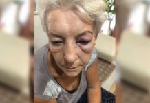 Pretučena žena u Novom Pazaru! U subotu najavljen protest ispred Policijske uprave pretucena-zena-u-novom-pazaru!-u-subotu-najavljen-protest-ispred-policijske-uprave