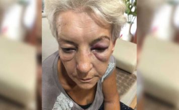 Pretučena žena u Novom Pazaru! U subotu najavljen protest ispred Policijske uprave pretucena-zena-u-novom-pazaru!-u-subotu-najavljen-protest-ispred-policijske-uprave