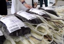 Krv dale 64 osobe krv-dale-64-osobe