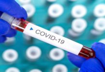 POSKUPLJUJE CENA PCR TESTA: Od sutra za testiranje na lični zahtev 9.000 dinara poskupljuje-cena-pcr-testa:-od-sutra-za-testiranje-na-licni-zahtev-9.000-dinara