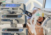 ”Bežanijska kosa” puna, teže kliničke slike pacijenata ”bezanijska-kosa”-puna,-teze-klinicke-slike-pacijenata