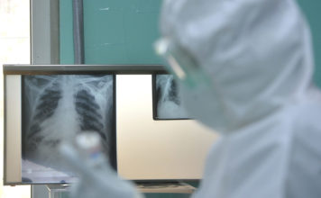 U Srbiji 579 novoraženih kovidom, preminule tri osobe u-srbiji-579-novorazenih-kovidom,-preminule-tri-osobe