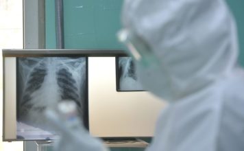 Infektolog Stevanović upozorio na mogućnost sudara korone i gripa infektolog-stevanovic-upozorio-na-mogucnost-sudara-korone-i-gripa