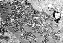 CDC upozorio na 6 simptoma omikrona i hitno javljanje lekaru cdc-upozorio-na-6-simptoma-omikrona-i-hitno-javljanje-lekaru