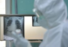 Epidemiolog: Omikronom će do aprila biti zaraženo 70 odsto gradjana Srbije epidemiolog:-omikronom-ce-do-aprila-biti-zarazeno-70-odsto-gradjana-srbije