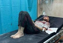 Oko 650 pacijenata u životnoj opasnosti zbog katastrofalne situacije u bolnici Al-Shifa u Gazi oko-650-pacijenata-u-zivotnoj-opasnosti-zbog-katastrofalne-situacije-u-bolnici-al-shifa-u-gazi