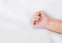 Novi Pazar bukti od morbila novi-pazar-bukti-od-morbila