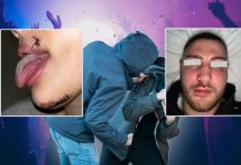 Užas u Beogradu: Prebijeni mladići i djevojke iz Hrvatske, djevojci zašivali jezik uzas-u-beogradu:-prebijeni-mladici-i-djevojke-iz-hrvatske,-djevojci-zasivali-jezik