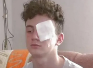 Ostao bez oka i prstiju zbog petarde: Tragična novogodišnja noć petnaestogodišnjaka ostao-bez-oka-i-prstiju-zbog-petarde:-tragicna-novogodisnja-noc-petnaestogodisnjaka