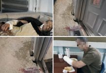 UŽAS: Psi lutalice napali bivšeg specijalca Mithata Z. – teško povrijeđen ispred kuće uzas:-psi-lutalice-napali-bivseg-specijalca-mithata-z.-–-tesko-povrijedjen-ispred-kuce