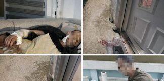 UŽAS: Psi lutalice napali bivšeg specijalca Mithata Z. – teško povrijeđen ispred kuće uzas:-psi-lutalice-napali-bivseg-specijalca-mithata-z.-–-tesko-povrijedjen-ispred-kuce