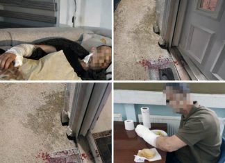 UŽAS: Psi lutalice napali bivšeg specijalca Mithata Z. – teško povrijeđen ispred kuće uzas:-psi-lutalice-napali-bivseg-specijalca-mithata-z.-–-tesko-povrijedjen-ispred-kuce